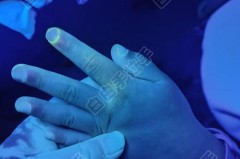 伍德灯检查有害吗 - 实时动态分类下的文章配图