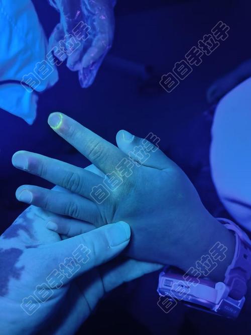 伍德灯检查有害吗